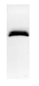 Anti-S100 alpha antibody used in Western Blot (WB). GTX11428