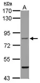 Anti-Filensin antibody [N1C1] used in Western Blot (WB). GTX114282