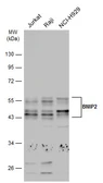 Anti-BNIP2 antibody used in Western Blot (WB). GTX114283