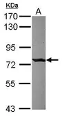 Anti-C1s antibody [C1C3] used in Western Blot (WB). GTX114291