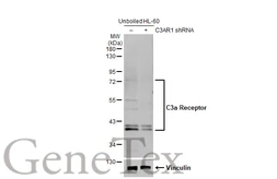 Anti-C3a Receptor antibody used in Western Blot (WB). GTX114293