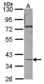 Anti-CA11 antibody [N1C3] used in Western Blot (WB). GTX114297