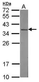 Anti-CAPZA2 antibody [N2C3] used in Western Blot (WB). GTX114303