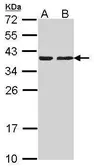 Anti-CAPZA2 antibody [N2C3] used in Western Blot (WB). GTX114303