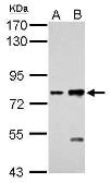 Anti-K-Cadherin antibody [N3C2], Internal used in Western Blot (WB). GTX114313