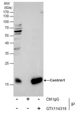 Anti-Centrin 1 antibody [N1C3] used in Immunoprecipitation (IP). GTX114316