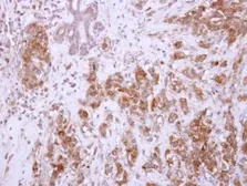 Anti-CHAD antibody used in IHC (Paraffin sections) (IHC-P). GTX114318