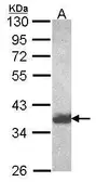 Anti-HSD3a antibody [N1C2-2] used in Western Blot (WB). GTX114319