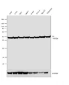 Anti-PDIA6 antibody used in Western Blot (WB). GTX11432