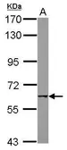 Anti-AChR beta 1 antibody [C1C3] used in Western Blot (WB). GTX114323