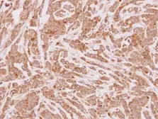 Anti-CPT1A antibody [C1C2], Internal used in IHC (Paraffin sections) (IHC-P). GTX114337
