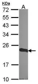Anti-CSRP1 antibody [N1C3] used in Western Blot (WB). GTX114344