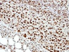 Anti-cleavage stimulation factor antibody [N1C1] used in IHC (Paraffin sections) (IHC-P). GTX114345