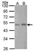 Anti-CtBP2 antibody [N1N3] used in Western Blot (WB). GTX114346