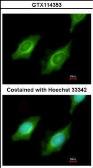 Anti-CYP4A11 antibody [N3C3] used in Immunocytochemistry/ Immunofluorescence (ICC/IF). GTX114353