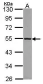Anti-CYP4A11 antibody [N3C3] used in Western Blot (WB). GTX114353