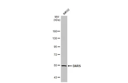 Anti-DARS antibody used in Western Blot (WB). GTX114356