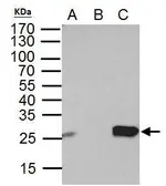 Anti-DTYMK antibody used in Immunoprecipitation (IP). GTX114371