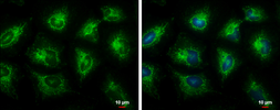 Anti-ECHS1 antibody used in Immunocytochemistry/ Immunofluorescence (ICC/IF). GTX114375