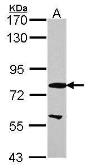 Anti-EML1 antibody [N1N3] used in Western Blot (WB). GTX114381
