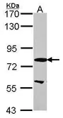 Anti-EML1 antibody [N1N3] used in Western Blot (WB). GTX114381