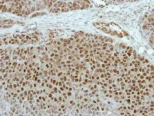 Anti-ERM antibody used in IHC (Paraffin sections) (IHC-P). GTX114394