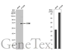 Anti-ERM antibody used in Western Blot (WB). GTX114394