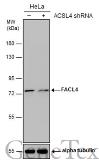 Anti-FACL4 antibody [N1N3] used in Western Blot (WB). GTX114399