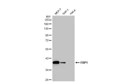 Anti-FBP1 antibody used in Western Blot (WB). GTX114401