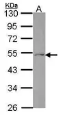 Anti-Ferredoxin Reductase antibody [N1C1] used in Western Blot (WB). GTX114402