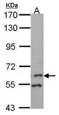 Anti-FMO1 antibody [N2C1], Internal used in Western Blot (WB). GTX114412