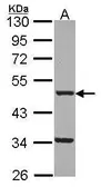 Anti-FNTB antibody [N1C1] used in Western Blot (WB). GTX114415