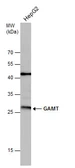 Anti-GAMT antibody [N1C3] used in Western Blot (WB). GTX114420