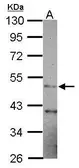 Anti-GATM antibody [N3C3] used in Western Blot (WB). GTX114423