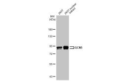 Anti-GCN5 antibody [C2C3], C-term used in Western Blot (WB). GTX114428