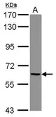 Anti-GGT5 antibody [N1C1] used in Western Blot (WB). GTX114432