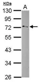 Anti-GPD2 antibody [N1N3] used in Western Blot (WB). GTX114447