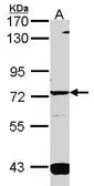 Anti-GUCY1A3 antibody [C1C3] used in Western Blot (WB). GTX114458