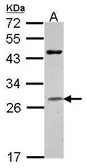 Anti-Granzyme H antibody [N2C3] used in Western Blot (WB). GTX114460