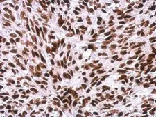 Anti-Histone H1.0 antibody used in IHC (Paraffin sections) (IHC-P). GTX114462