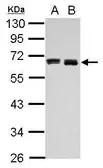 Anti-HAS3 antibody used in Western Blot (WB). GTX114465