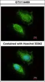 Anti-HIP2 antibody used in Immunocytochemistry/ Immunofluorescence (ICC/IF). GTX114469