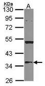 Anti-HMGCL antibody [N2C3] used in Western Blot (WB). GTX114472