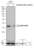 Anti-hnRNP A2B1 antibody used in Western Blot (WB). GTX114475