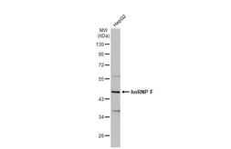 Anti-hnRNP F antibody [N1N3] used in Western Blot (WB). GTX114476