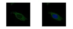 Anti-HSD17B3 antibody used in Immunocytochemistry/ Immunofluorescence (ICC/IF). GTX114480