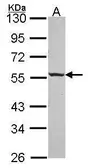 Anti-ICA1 antibody [N1N3] used in Western Blot (WB). GTX114483