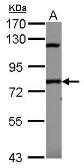 Anti-SP110 antibody [N1N2], N-term used in Western Blot (WB). GTX114489