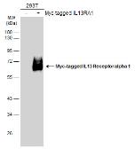 Anti-IL13 Receptor alpha 1 antibody [N1C1] used in Western Blot (WB). GTX114494