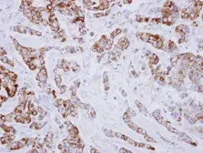 Anti-IVD antibody used in IHC (Paraffin sections) (IHC-P). GTX114502